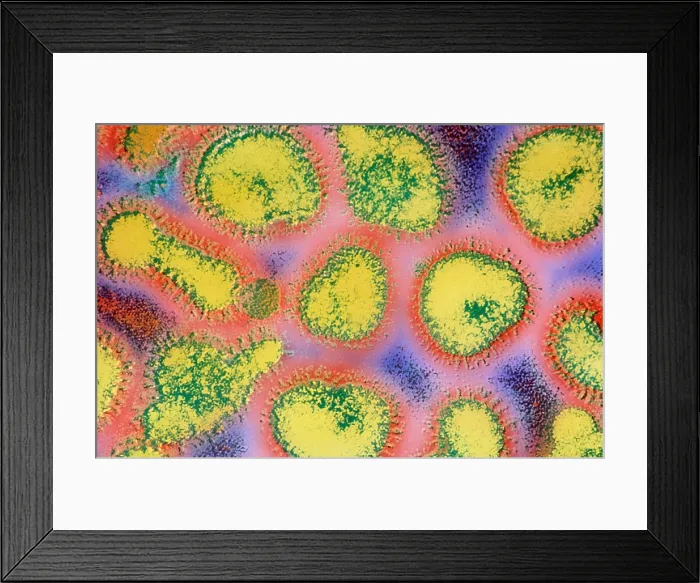 Framed Print : Influenza (TEM) Framed Print : Influenza (TEM)