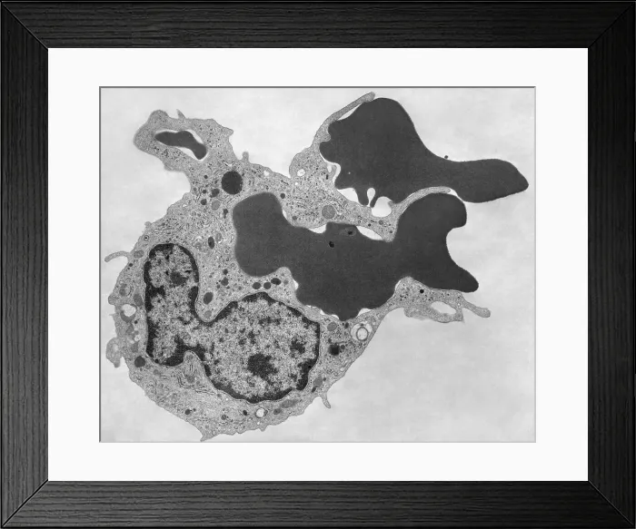 Framed Print : Human Phagocyte, Phagocytosis, TEM Framed Print : Human Phagocyte, Phagocytosis, TEM