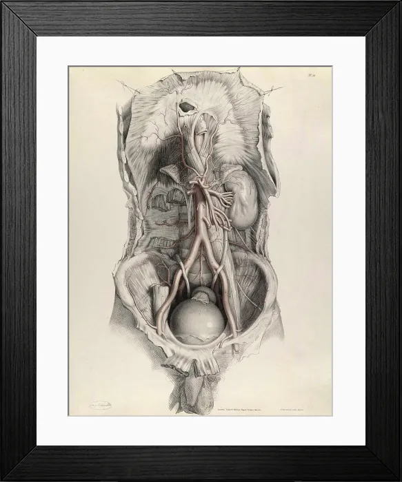 Framed Print : Historical Anatomical Illustration Framed Print : Historical Anatomical Illustration