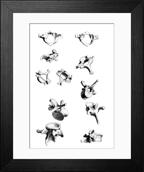 Framed Print : William Cheselden, 'Osteographia', 1733