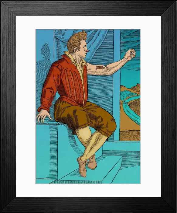 Framed Print : Tagliacozzi Rhinoplasty Method