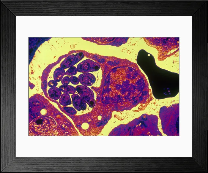 Framed Print : Malaria, Plasmodium cathemerium, TEM Framed Print : Malaria, Plasmodium cathemerium, TEM