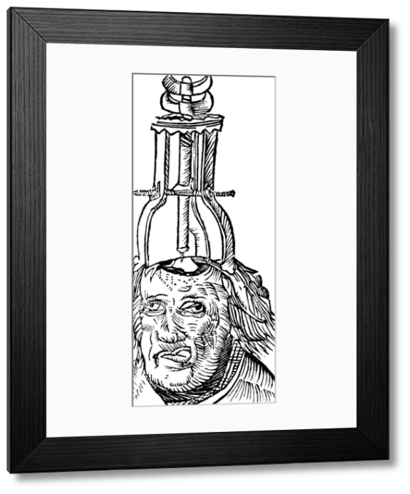 Framed Print : Trepanning, 1525 Framed Print : Trepanning, 1525