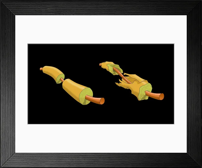 Framed Print : Nerve Demyelination of the myelin sheath, causes include multiple sclerosis (MS) disease, toxins, infections, Illustration Framed Print : Nerve Demyelination of the myelin sheath, causes include multiple sclerosis (MS) disease, toxins, infections, Illustration