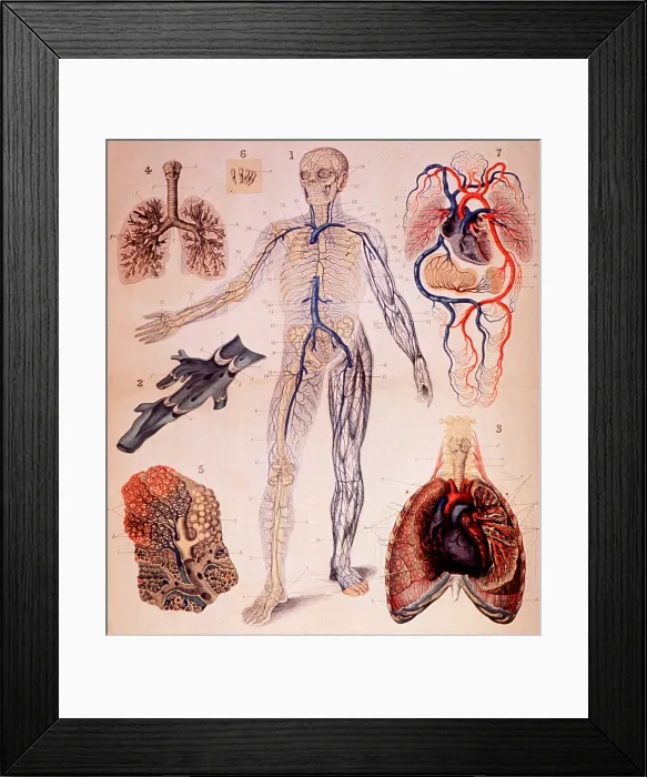 Framed Print : Veins and Lungs, Human Anatomy Atlas Framed Print : Veins and Lungs, Human Anatomy Atlas