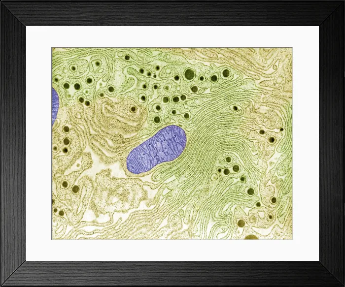 Framed Print : Pancreas, Endoplasmic Reticulum, TEM