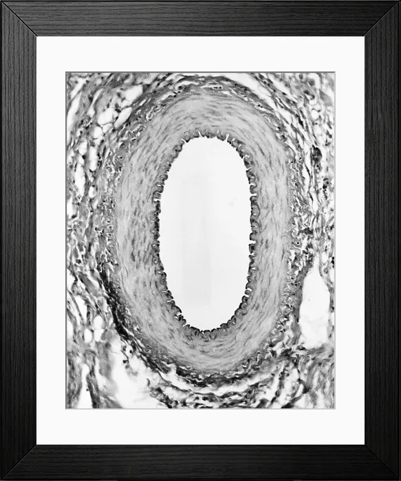 Framed Print : Circulatory System, Healthy Artery, TEM Framed Print : Circulatory System, Healthy Artery, TEM