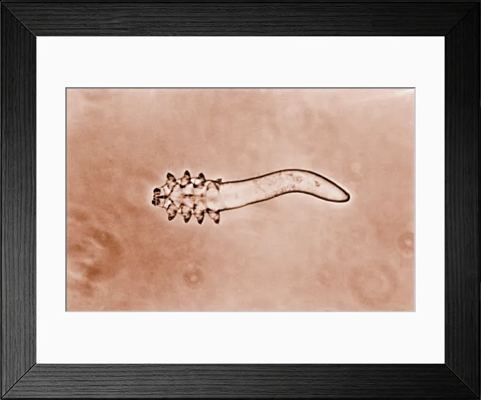 Framed Print : Hair follicle mite Framed Print : Hair follicle mite