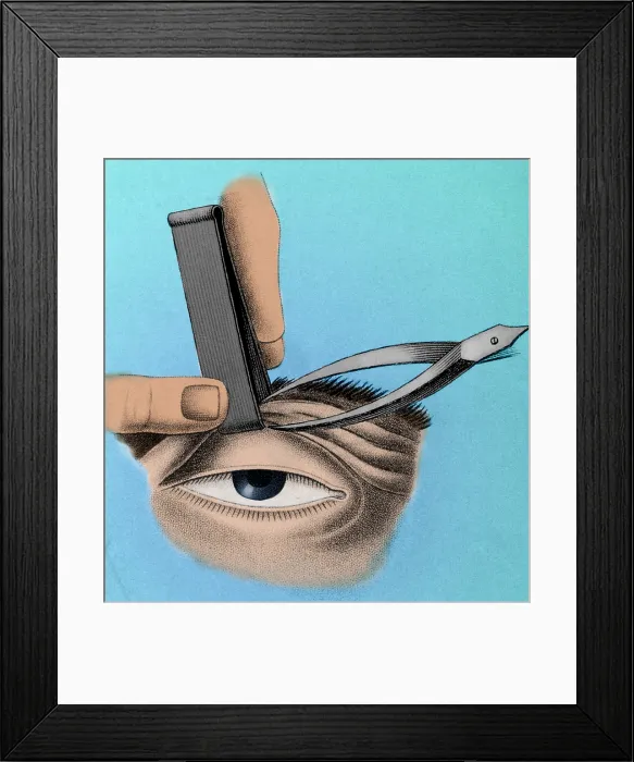 Framed Print : Surgery to Correct Lazy Eyelid, 1830