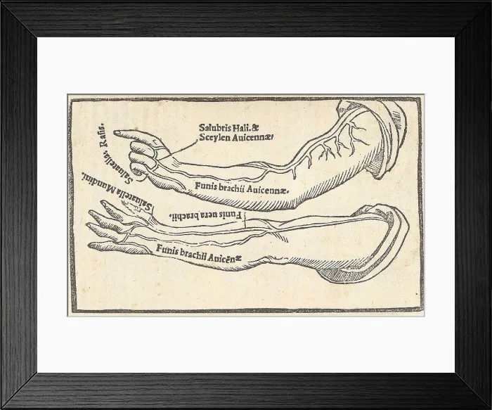 Framed Print : Jacopo Berengario da Carpi, Arteries Framed Print : Jacopo Berengario da Carpi, Arteries