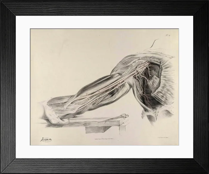 Framed Print : Historical Anatomical Illustration
