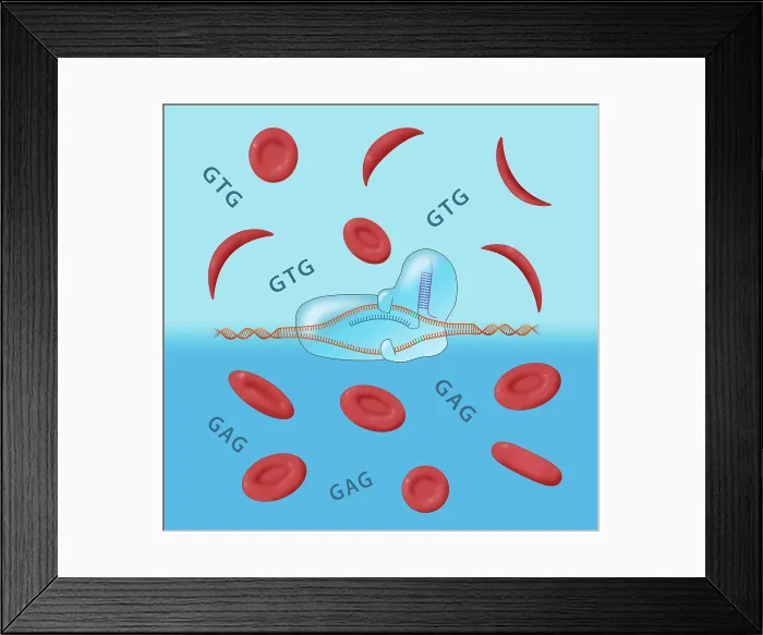 Framed Print : CRISPR cure for Sickle cell anemia disease and Normal Blood Cells, gtg, gag, Conceptual Illustration Framed Print : CRISPR cure for Sickle cell anemia disease and Normal Blood Cells, gtg, gag, Conceptual Illustration