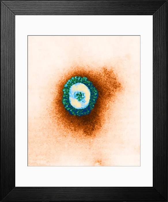 Framed Print : Coronavirus, TEM Framed Print : Coronavirus, TEM