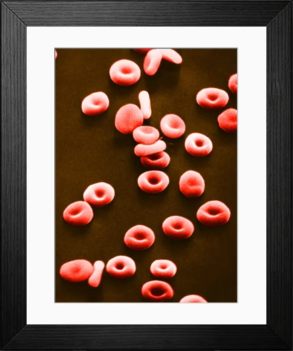 Framed Print : Red Blood Cells, under a microscope (SEM) Framed Print : Red Blood Cells, under a microscope (SEM)