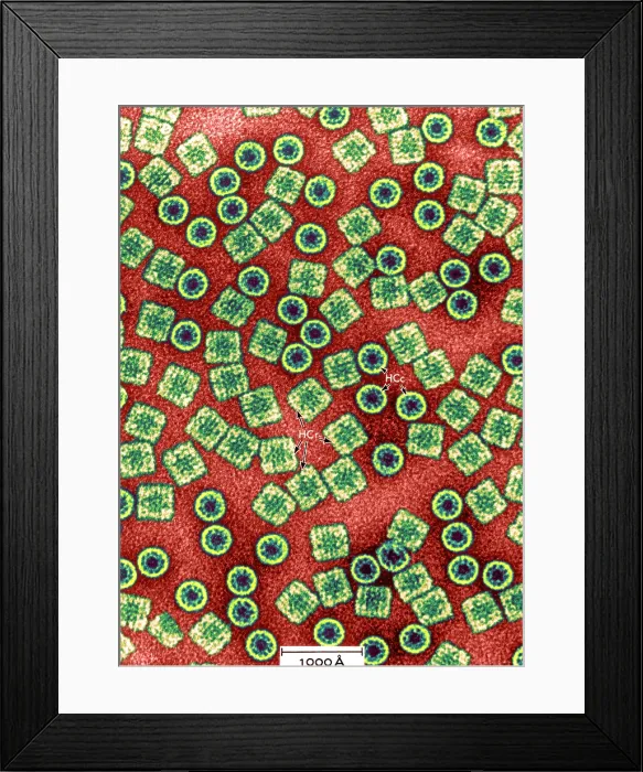 Framed Print : Respiratory Protein, Hemocyanin, TEM Framed Print : Respiratory Protein, Hemocyanin, TEM
