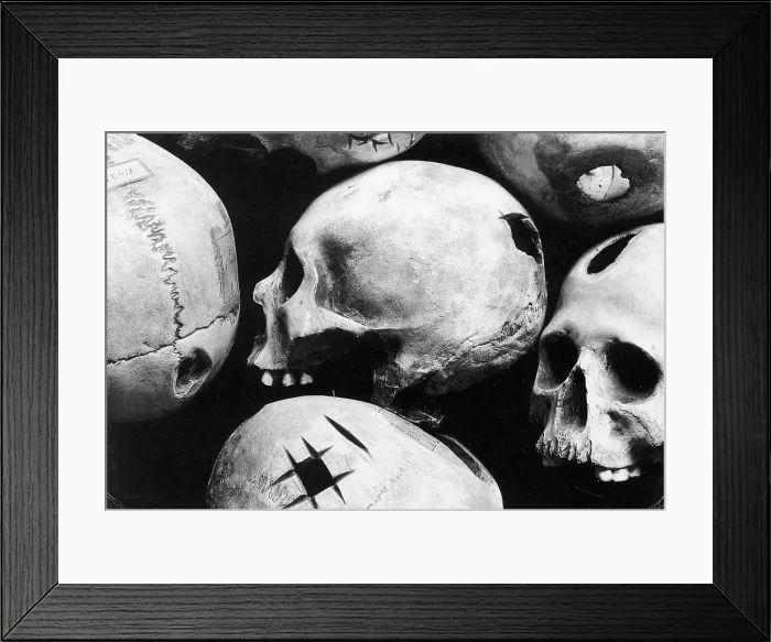Framed Print : Skulls Showing Trepanation