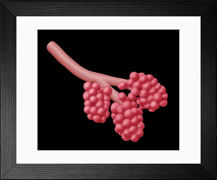 Framed Print : Alveoli. Illustration of alveoli, the small air sacs at the end of the respiratory tree 