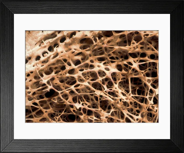Framed Print : Shin Connecting Bones SEM