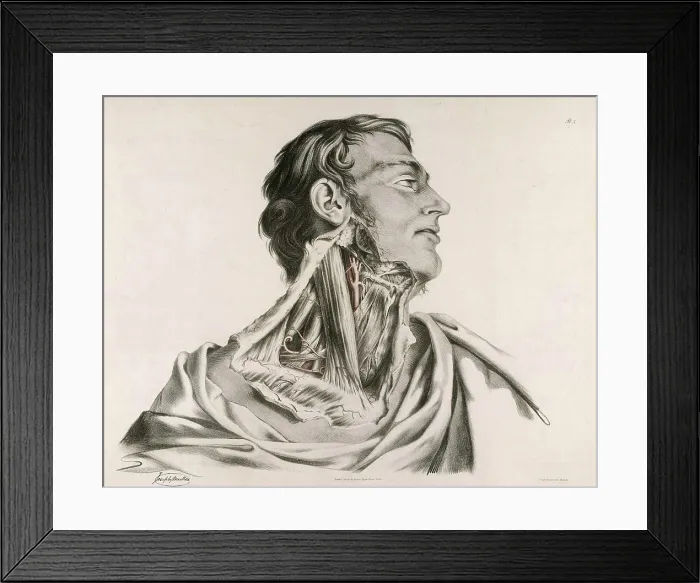 Framed Print : Historical anatomical illustration