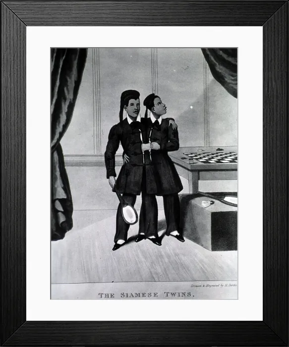 Framed Print : Chang and Eng Bunker, The Original Siamese Twins Framed Print : Chang and Eng Bunker, The Original Siamese Twins