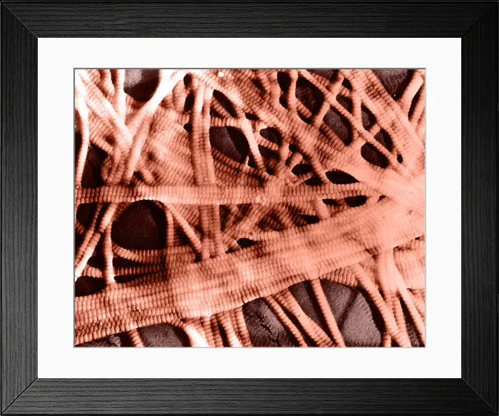 Framed Print : Integumentary System, Subcutaneous Tissue, TEM