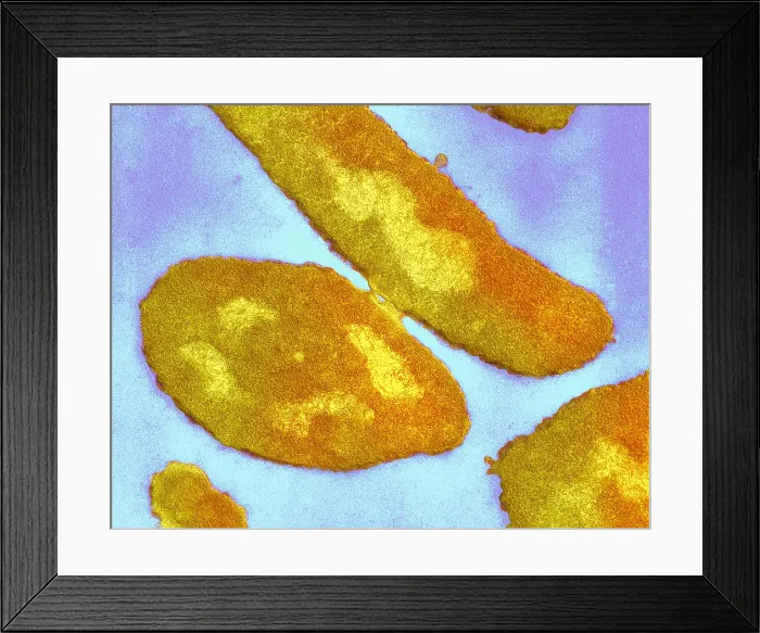 Framed Print : Bacteria, Genetic Recombination, TEM Framed Print : Bacteria, Genetic Recombination, TEM