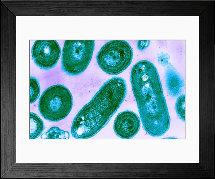 Framed Print : Blue-Green Algae, TEM Framed Print : Blue-Green Algae, TEM