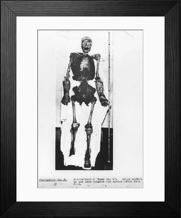 Framed Print : Skeletal Reconstruction, Buck Ruxton Murder