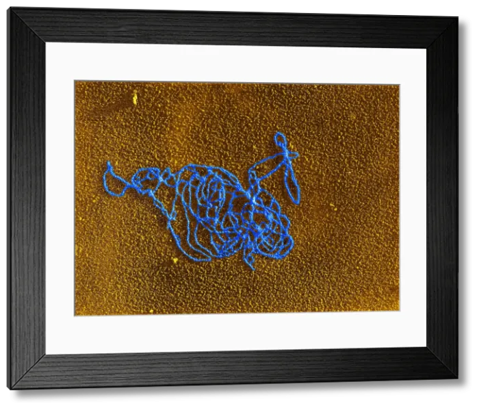 Framed Print : Polymerase Reaction, DNA with E. coli RNA, TEM