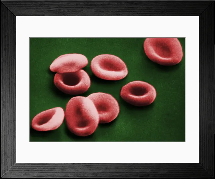 Framed Print : Red Blood Cells, under a microscope (SEM) Framed Print : Red Blood Cells, under a microscope (SEM)