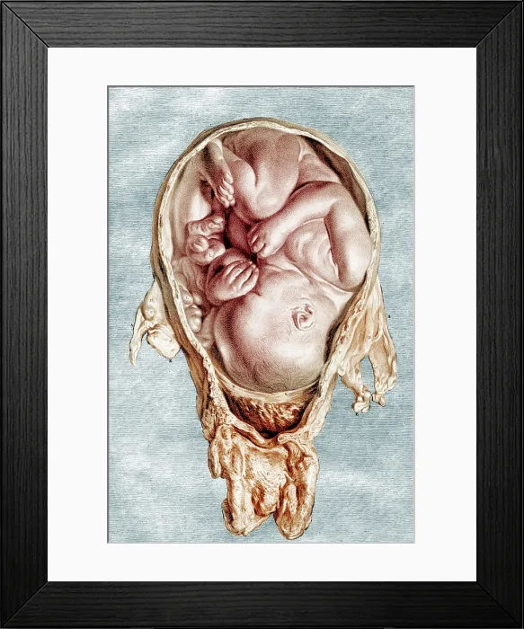 Framed Print : William Hunter, Anatomia uteri humani gravidi, 1774