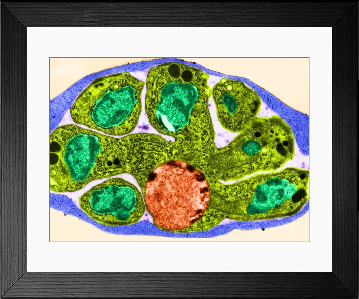Framed Print : Malaria, Plasmodium cathemerium, TEM Framed Print : Malaria, Plasmodium cathemerium, TEM