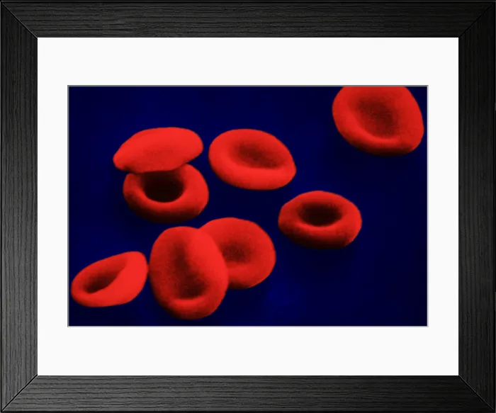 Framed Print : Red Blood Cells, under a microscope (SEM) Framed Print : Red Blood Cells, under a microscope (SEM)