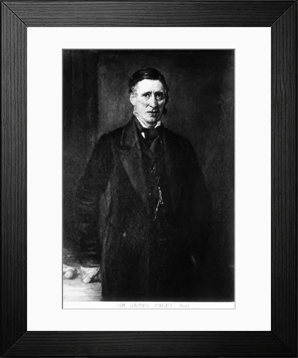 Framed Print : James Paget, English Surgeon and Pathologist Framed Print : James Paget, English Surgeon and Pathologist