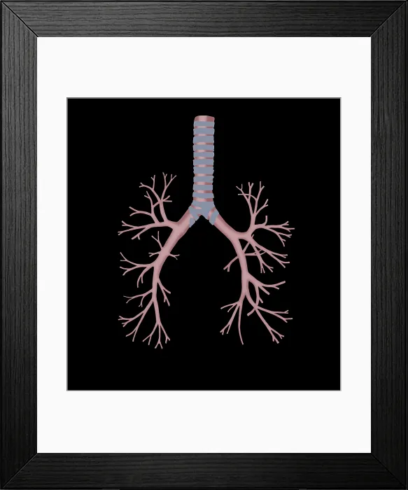 Framed Print : Bronchus. Illustration of the bronchus