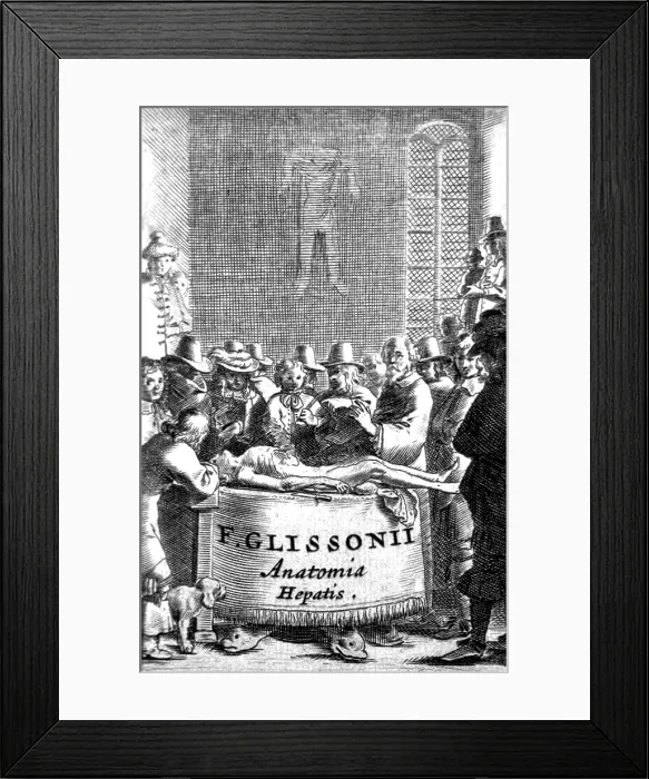 Framed Print : Anatomy Class, 1681 Framed Print : Anatomy Class, 1681