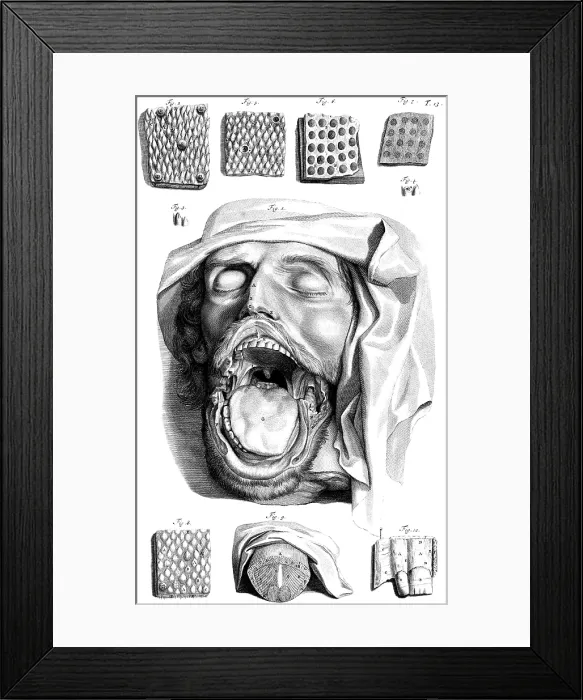 Framed Print : Anatomia humani corporis, Table 13, 1690 Framed Print : Anatomia humani corporis, Table 13, 1690