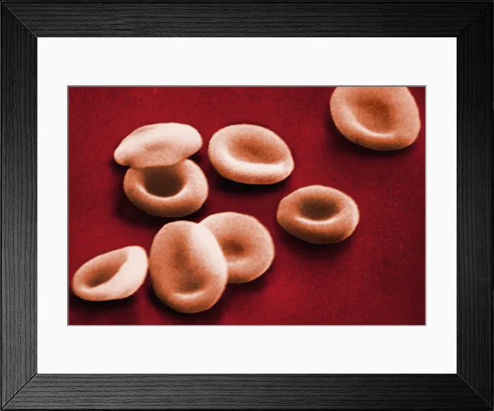 Framed Print : Red Blood Cells, under a microscope (SEM) Framed Print : Red Blood Cells, under a microscope (SEM)