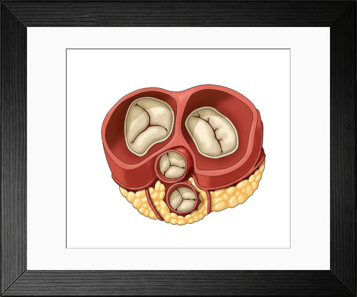 Framed Print : Heart Valves, Illustration