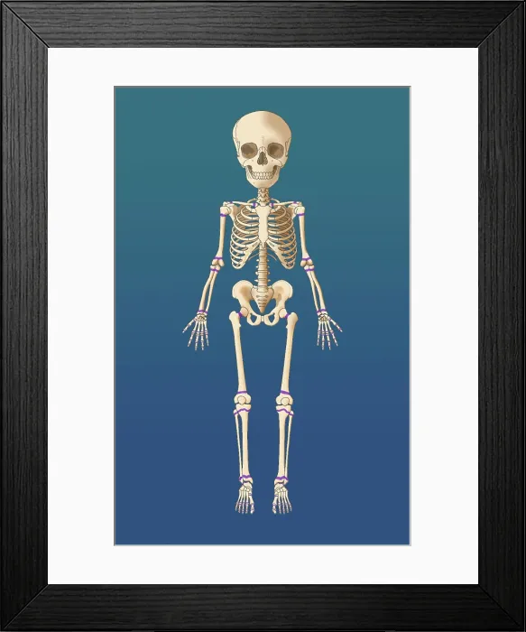 Framed Print : Child's Skeleton Growth Plates, Illustration Framed Print : Child's Skeleton Growth Plates, Illustration