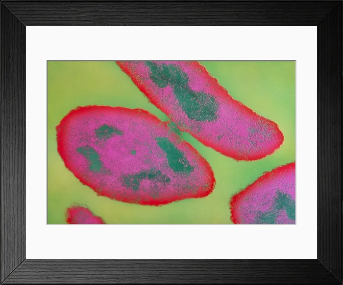 Framed Print : Bacteria, Genetic Recombination, TEM Framed Print : Bacteria, Genetic Recombination, TEM