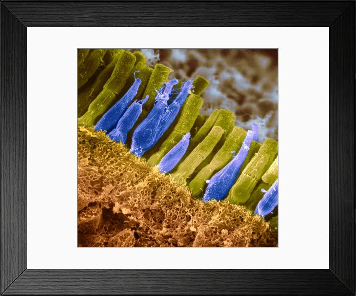 Framed Print : Rods and cones of the Eye's Retina, Under a Scanning Electron Microscope (SEM)