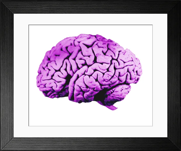 Framed Print : Human Brain