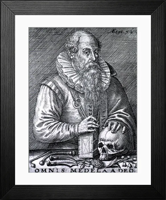 Framed Print : Wilhelm Fabry, German Surgeon Framed Print : Wilhelm Fabry, German Surgeon