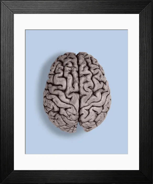 Framed Print : Human Brain, gross specimen Framed Print : Human Brain, gross specimen