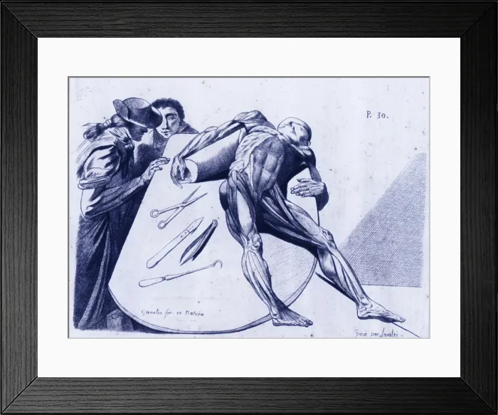 Framed Print : Contemplating a Cadaver Framed Print : Contemplating a Cadaver