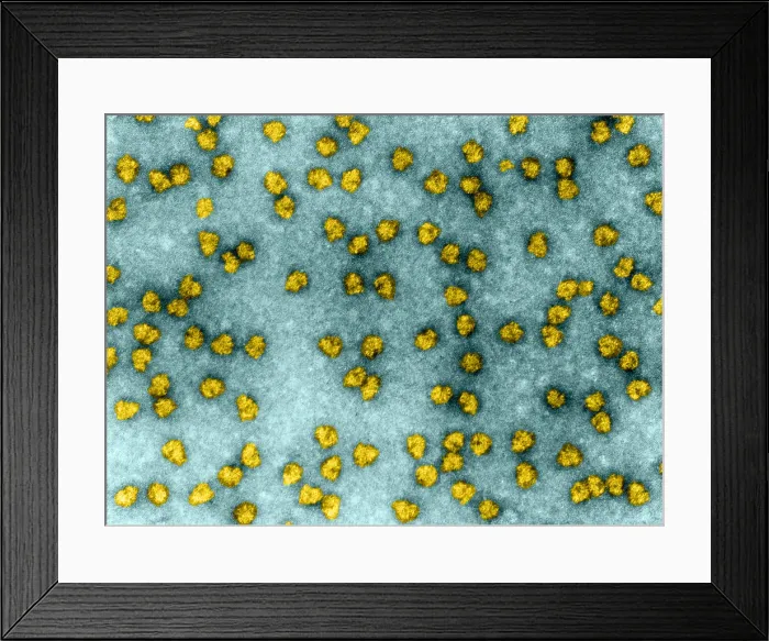 Framed Print : Cell Structure, Ribosomes, TEM