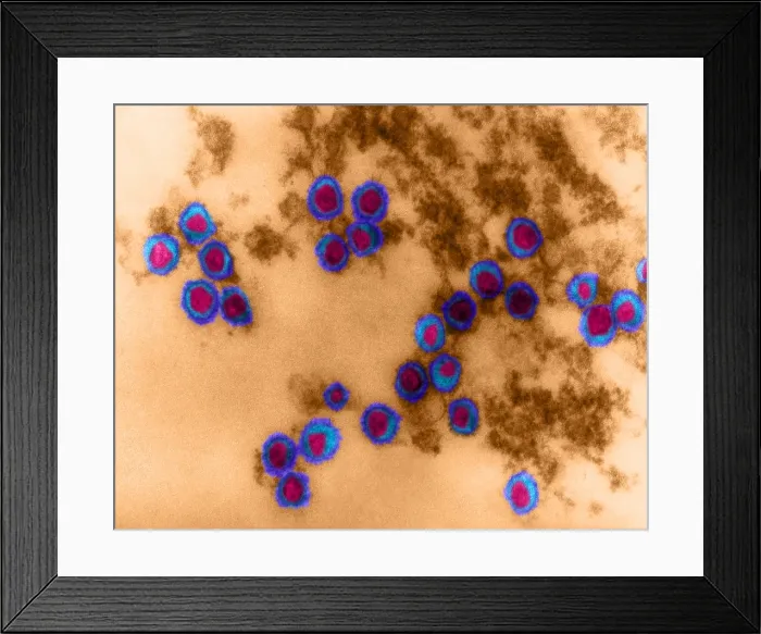 Framed Print : Rauscher Leukemia Virus, TEM Framed Print : Rauscher Leukemia Virus, TEM