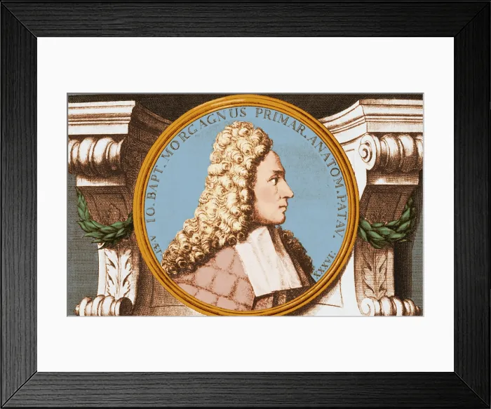 Framed Print : Giovanni Morgagni, Italian Anatomist Framed Print : Giovanni Morgagni, Italian Anatomist