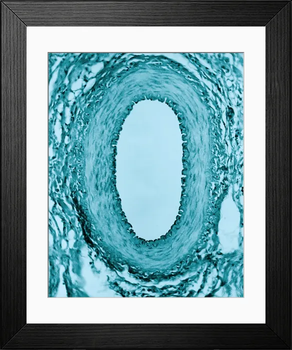 Framed Print : Circulatory System, Healthy Artery, TEM Framed Print : Circulatory System, Healthy Artery, TEM